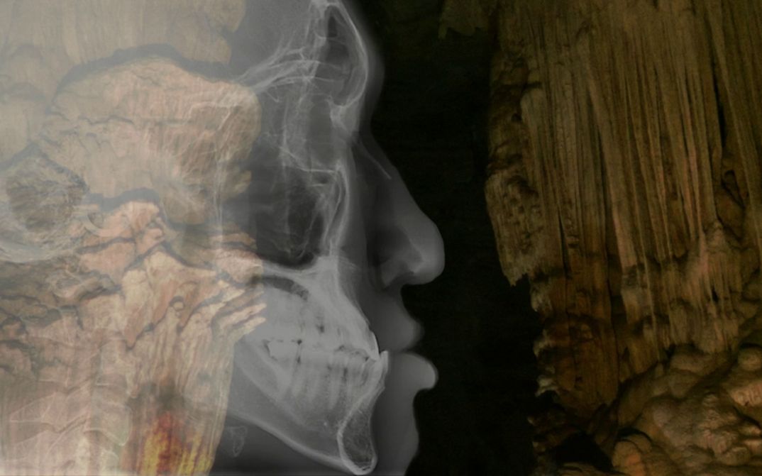 Filmstill aus dem Film „Mountain Roars“ von Chonchanok Thanatteepwong und Pobwarat Maprasob. Ein durch MRT enthülltes menschliches Profil mit seinen vielfachen anatomischen Schichten (Skelett, Gewebe, Haut) verschmilzt, in Überblendung, mit einer unterirdischen Höhle.